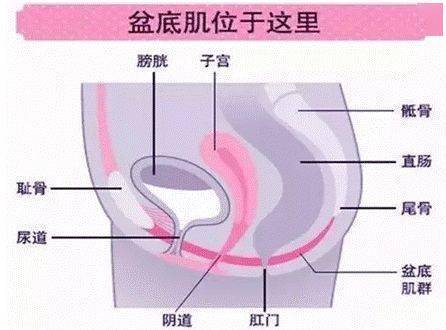 盆底肌修复_盆底肌康复有用吗_产后康复盆底肌