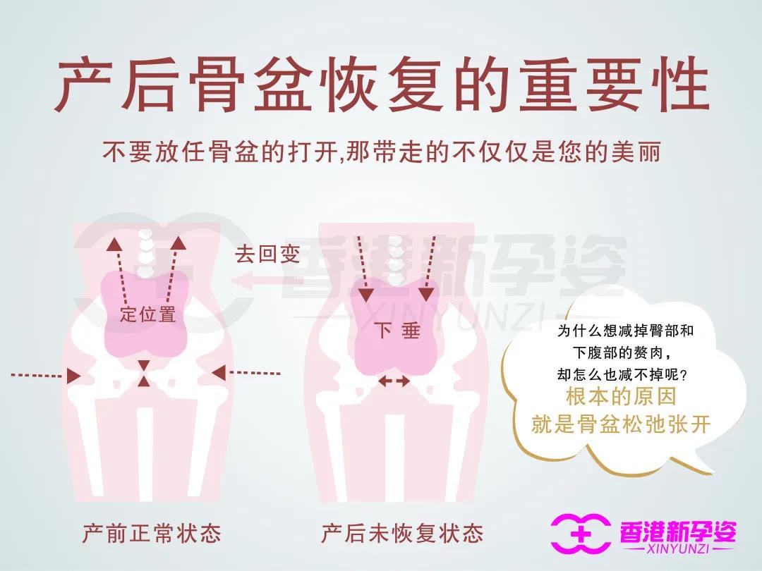 产后康复盆底肌_盆底肌修复_盆底肌康复有用吗
