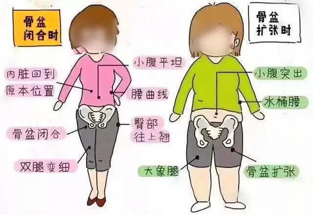盆底肌修复