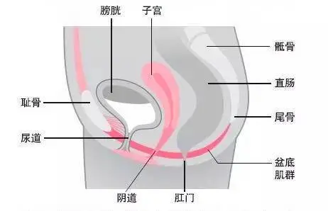 盆底肌修复