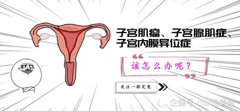 子宫腺肌症的症状_子宫腺肌症_子宫腺肌症怎么治疗