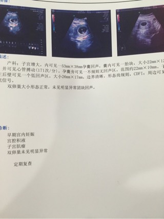 海外第三代试管婴儿宫腔环境怎么检查?(图5) 宫腔环境检查_宫腔镜检查后_白带清洁度3能做宫腔镜检查吗?