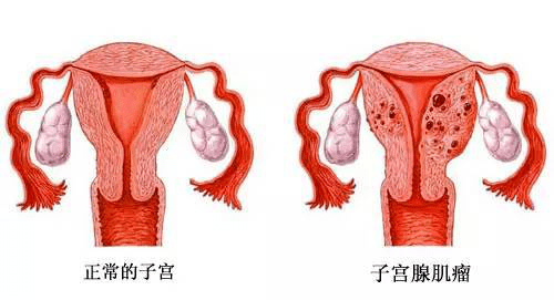 宫腔环境检查_宫腔镜检查术_什么情况做宫腔镜检查