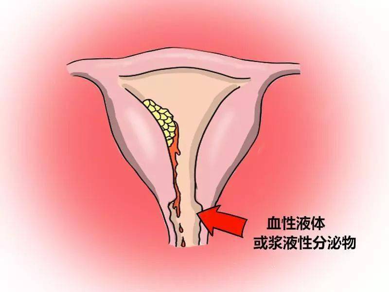 宫腔镜检查术_什么情况做宫腔镜检查_宫腔环境检查