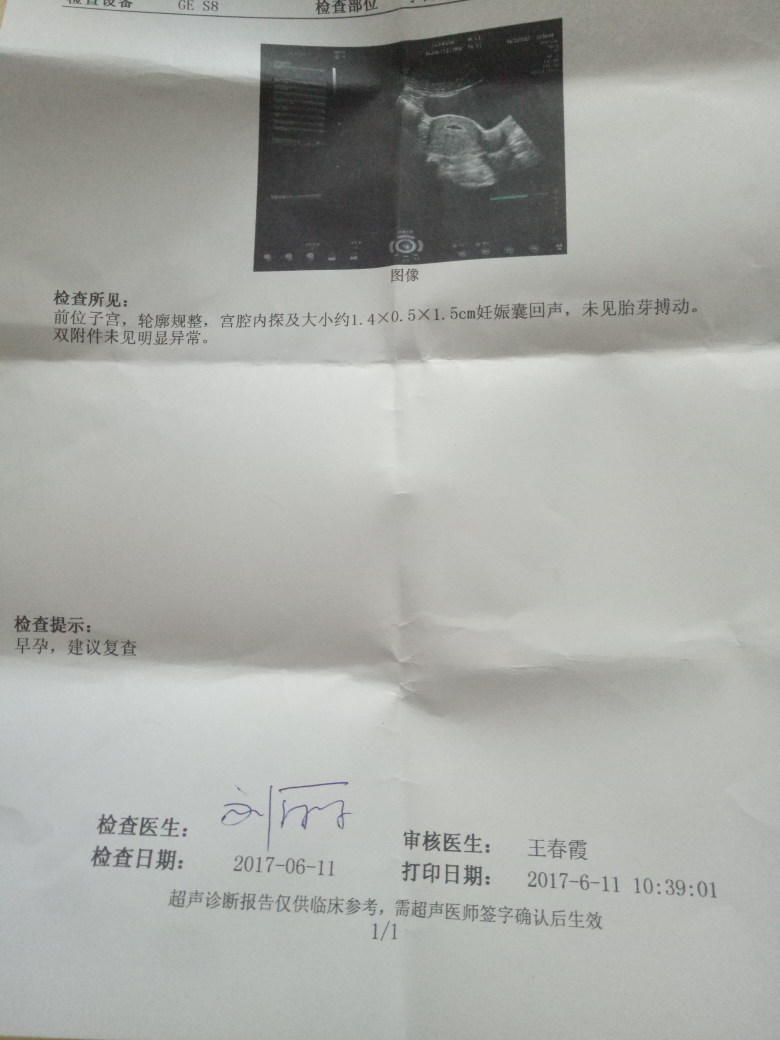 输卵管造影_怎么做输卵管超声造影_输卵管超声造影副作用