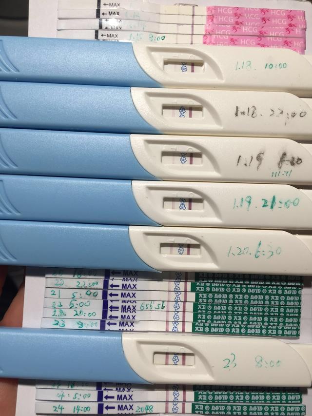 输卵管造影