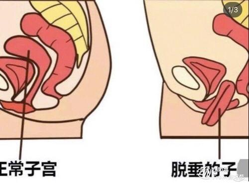 小月子_小月子月子餐_流产小月子注意事项