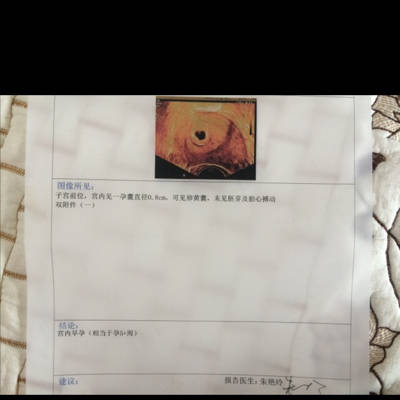 宫腔镜检查_复兴医院宫腔镜检查_宫腔镜检查