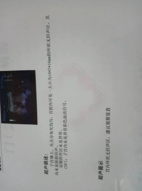 宫腔镜检查_复兴医院宫腔镜检查_宫腔镜检查