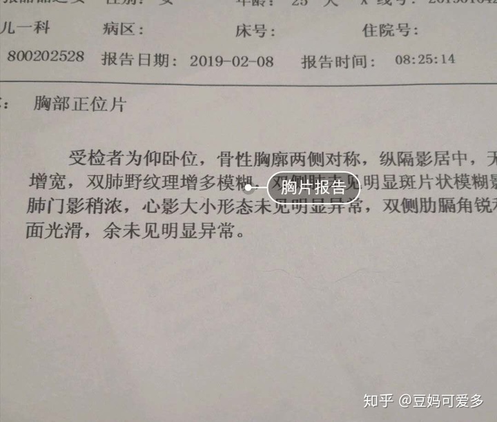 新生儿吐奶