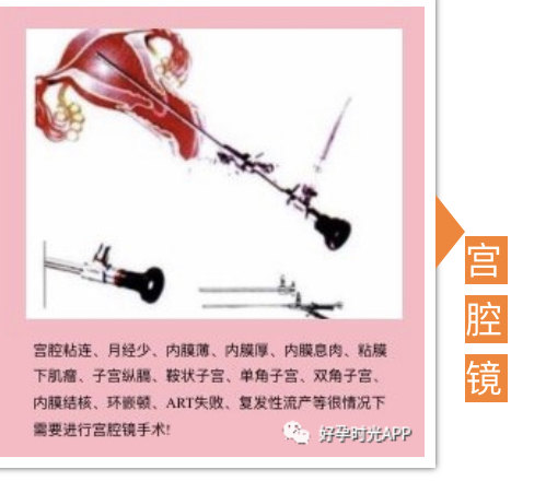 宫腔粘连