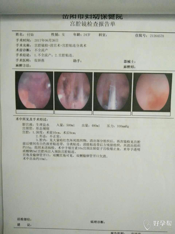 宫腔粘连_重度宮腔粘连图片_宫颈内口粘连