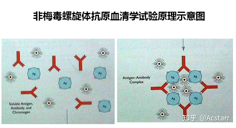 梅毒抗体