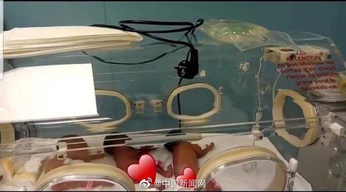多胎妊娠
