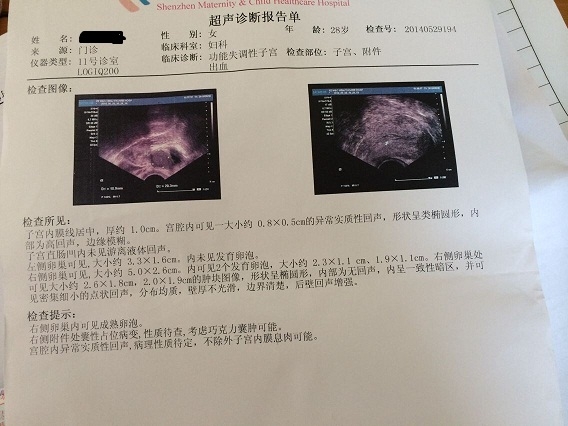 卵泡期用洗手液影响卵泡发育吗_窦卵泡计数_卵泡期卵泡多大