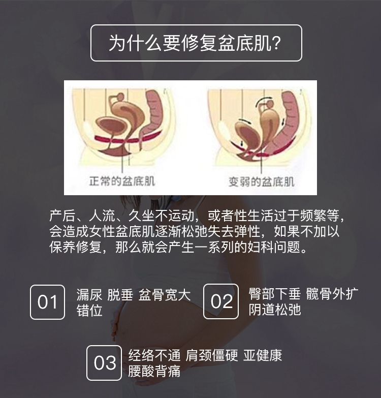 盆底肌康复治疗_盆底肌康复_盆底肌修复