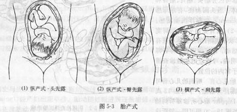 多胎妊娠_多胎妊娠减胎注意事项_足月妊娠胎心率