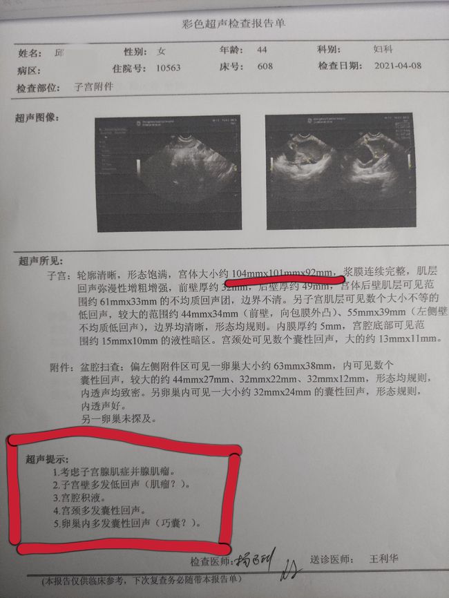 子宫腺肌症子宫腺肌瘤_什么是子宫腺肌症_子宫腺肌症
