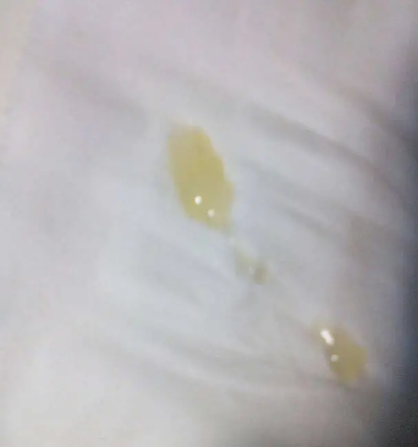 弱精症_弱精症_弱精症卡通