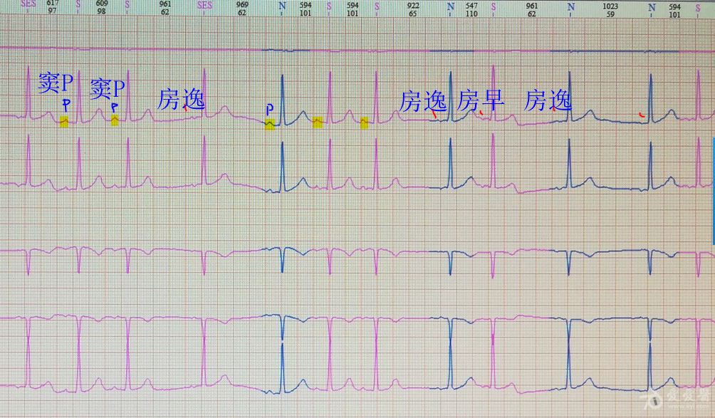 短QT间期综合征_征地区片综合地价_英短蓝猫尴尬期多久