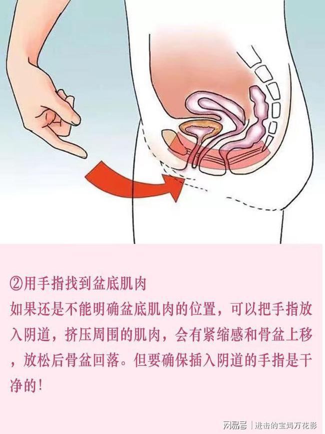 盆底肌修复_医院盆底肌康复_产后康复盆底肌