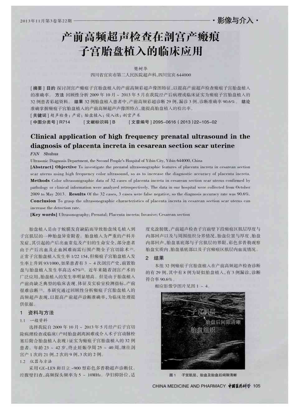 宫腔镜检查?_宫腔环境检查_什么是宫腔镜检查