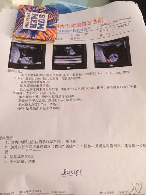 什么是宫腔镜检查_宫腔环境检查_宫腔镜检查?