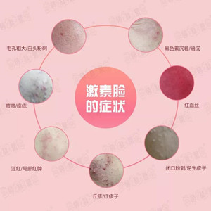 雌激素低怎么办_高灵敏促甲状腺激素低_男性激素六项雌二醇低