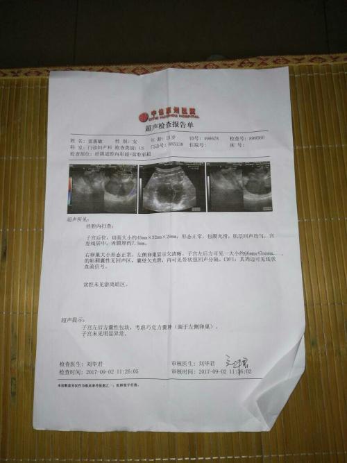 巧克力囊肿_皮样囊肿或皮脂腺囊肿图片_囊肿巧克力 囊肿
