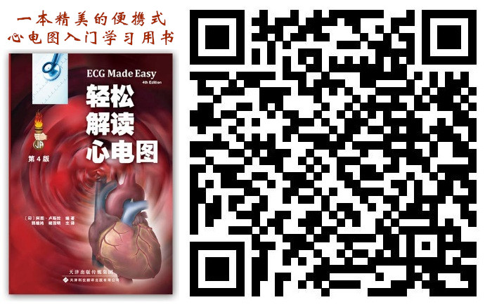 长QT间期综合征