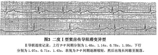 长益复线望城征拆标准_长QT间期综合征_哈尔滨市区征地区片综合地价表2011
