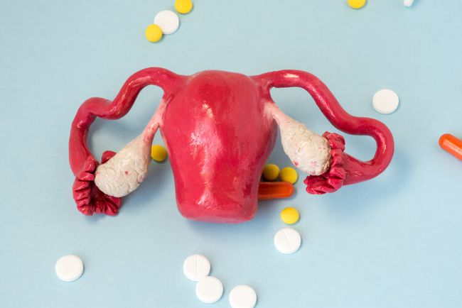 子宫腺肌症_子宫腺肌症的症状_子宫腺肌症与腺肌瘤