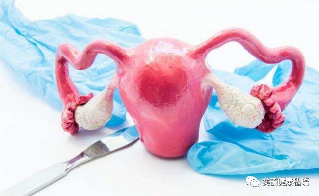 子宫腺肌症_子宫腺肌症的症状_子宫腺肌症与腺肌瘤