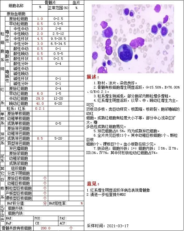nk细胞治疗_nk细胞_car–nk细胞