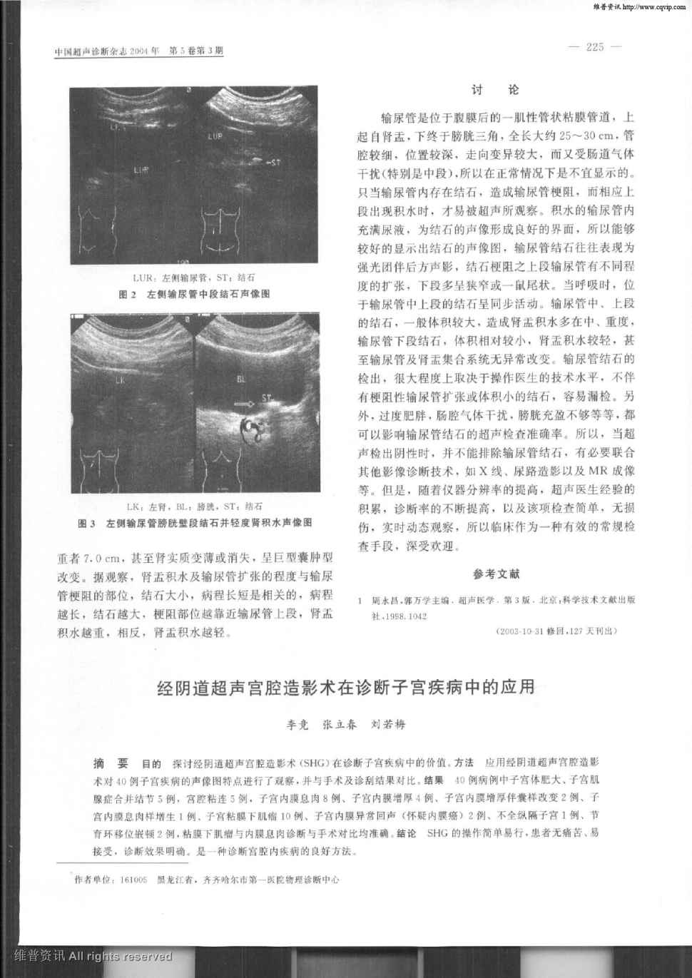 什么情况做宫腔镜检查_宫腔镜检查_宫腔镜检查