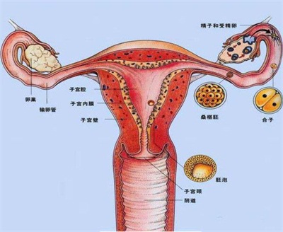 子宫腺肌症的治疗_子宫腺肌症的症状_子宫腺肌症