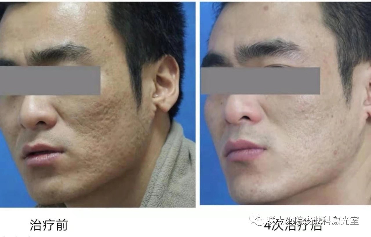 药房有回奶药吗_回奶药回奶痛吗_回奶药