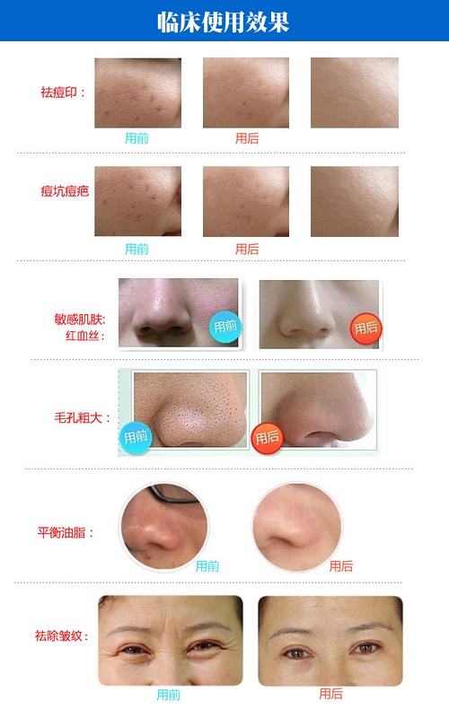 回奶药回奶痛吗_回奶药_药房有回奶药吗