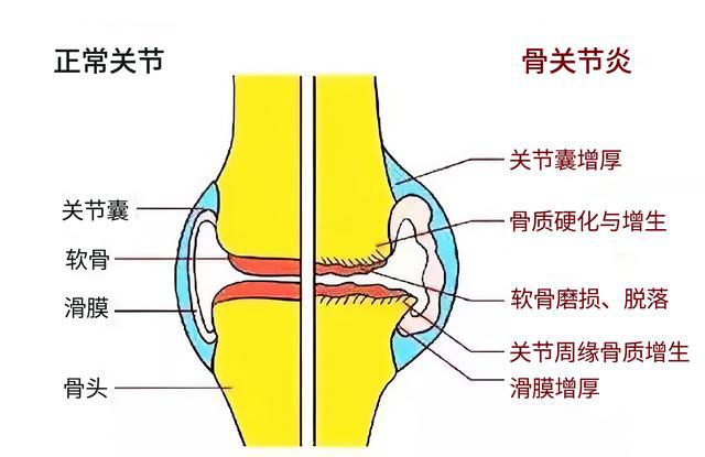 人促黄体生成激素低_雌激素低怎么办_激素引起的低钾怎么办