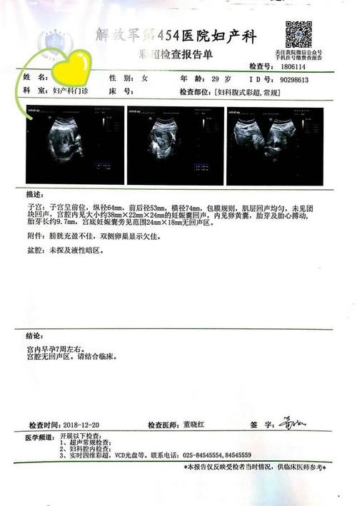 卵泡期用洗手液影响卵泡发育吗_窦卵泡计数_穿刺大卵泡,小卵泡能长大吗