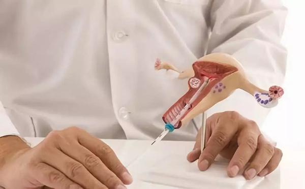 宫腔镜检查