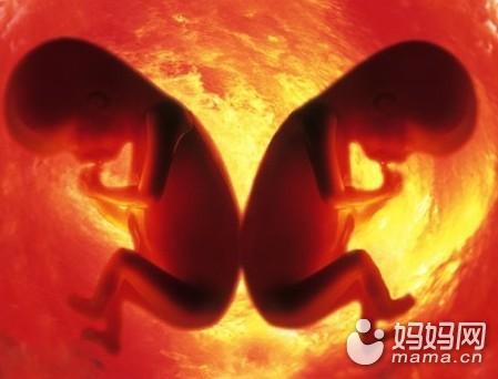 同卵双胞胎_双胞胎同卵异卵_试管双胞胎同卵