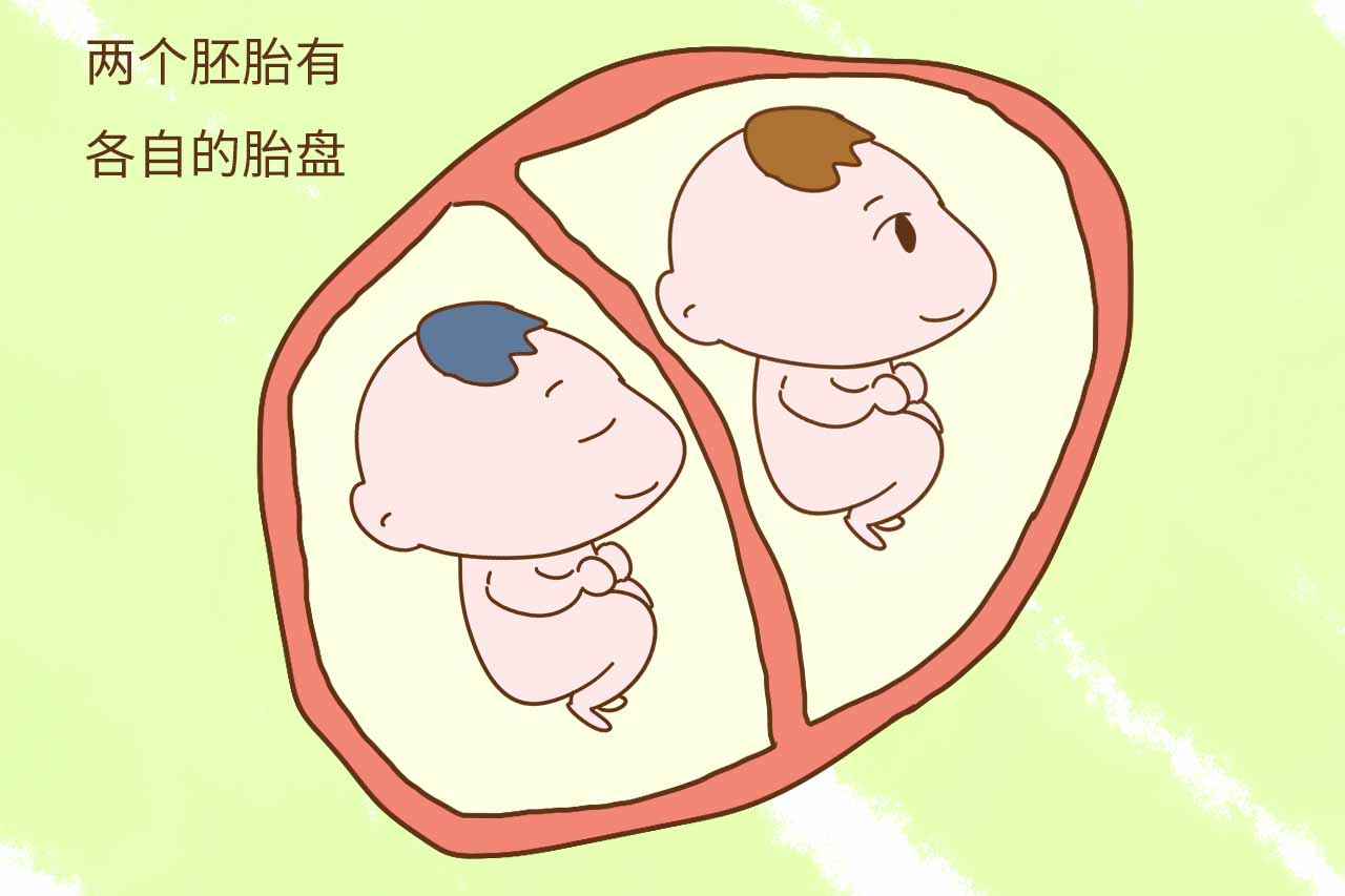 同卵双胞胎_试管双胞胎同卵_双胞胎同卵异卵