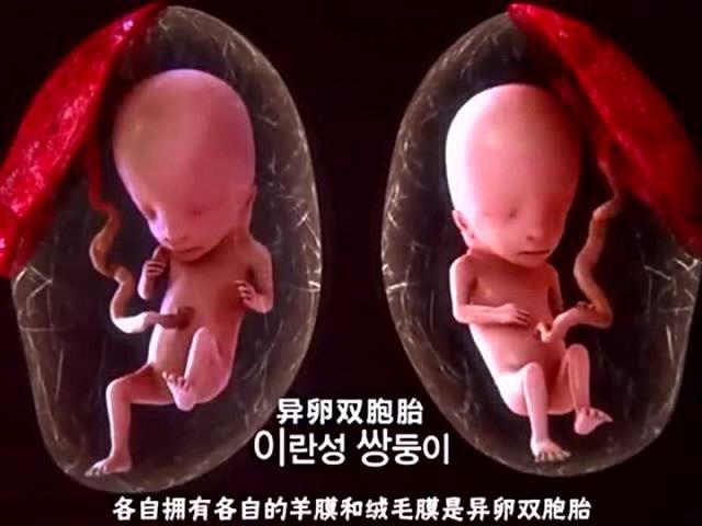 同卵双胞胎_试管双胞胎同卵_双胞胎同卵异卵