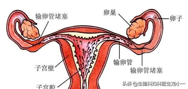 > 子宫输卵管造影中国专家共识(图3) 造影有疏通输卵管吗_输卵管造影_造影可以疏通输卵管吗