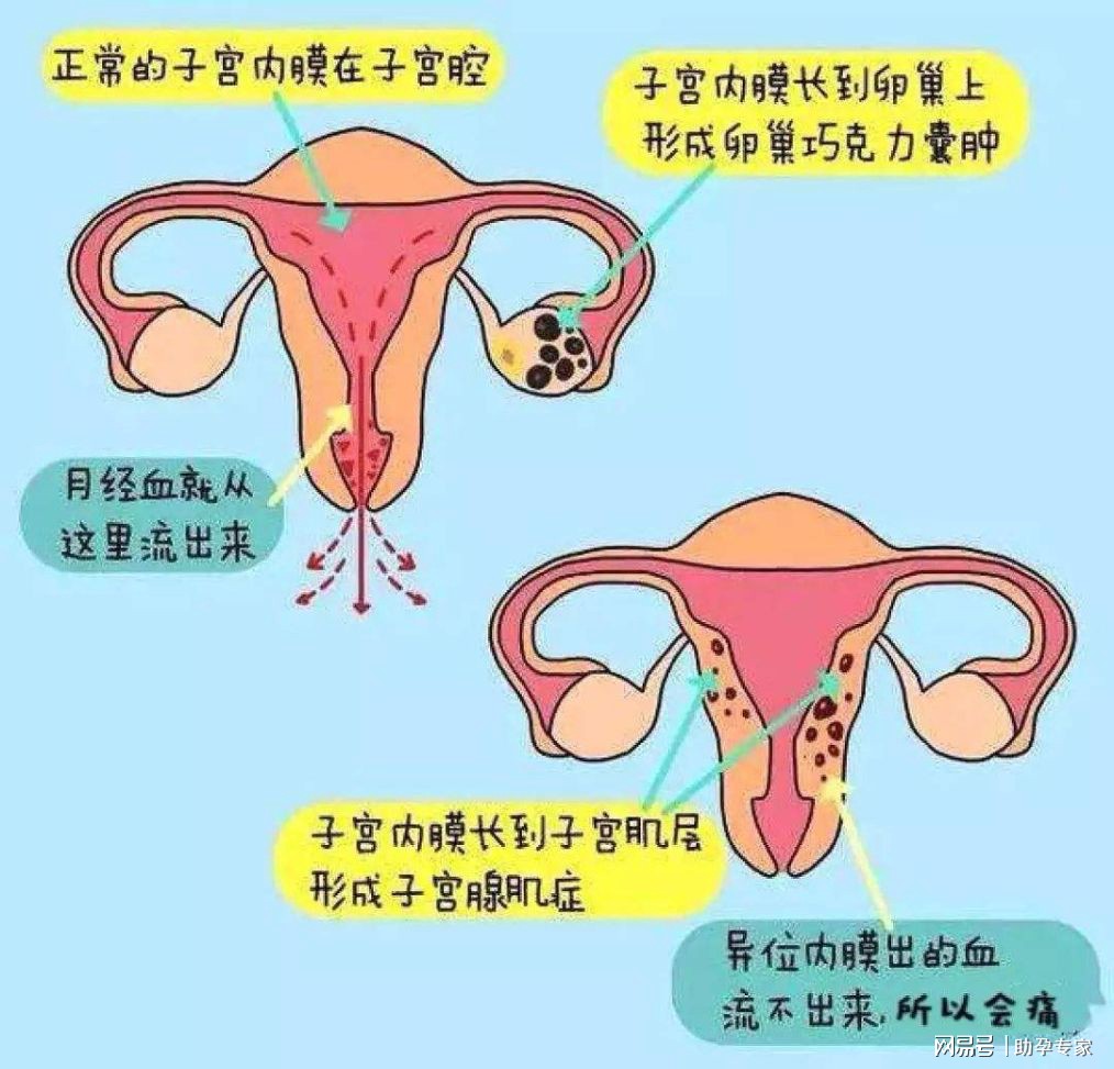 正常子宫宫内膜厚度_内膜厚度多少正常受孕吗_子宫内膜厚度