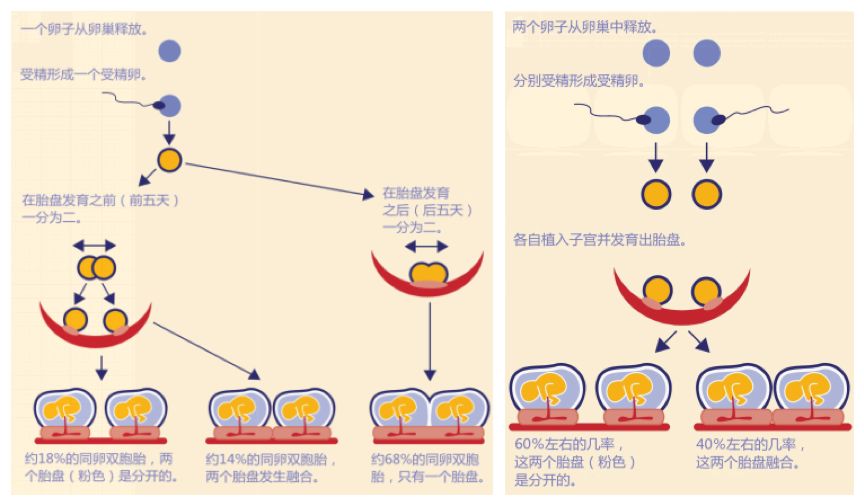 双胞胎同卵异卵_同卵双胞胎_同卵双胞胎和异卵双胞胎