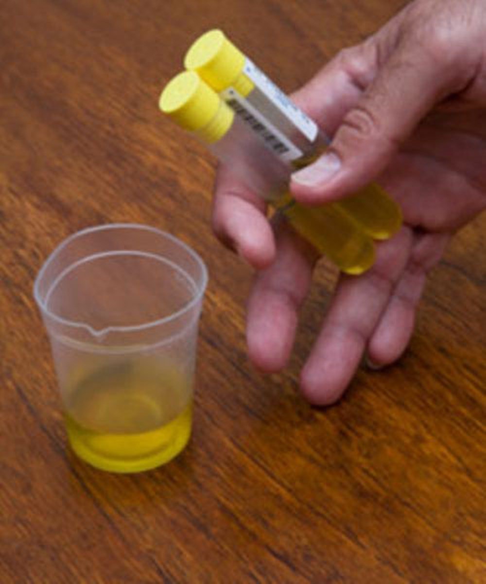 验孕棒_验孕纸最早能验孕时间_把电击棒当自慰棒