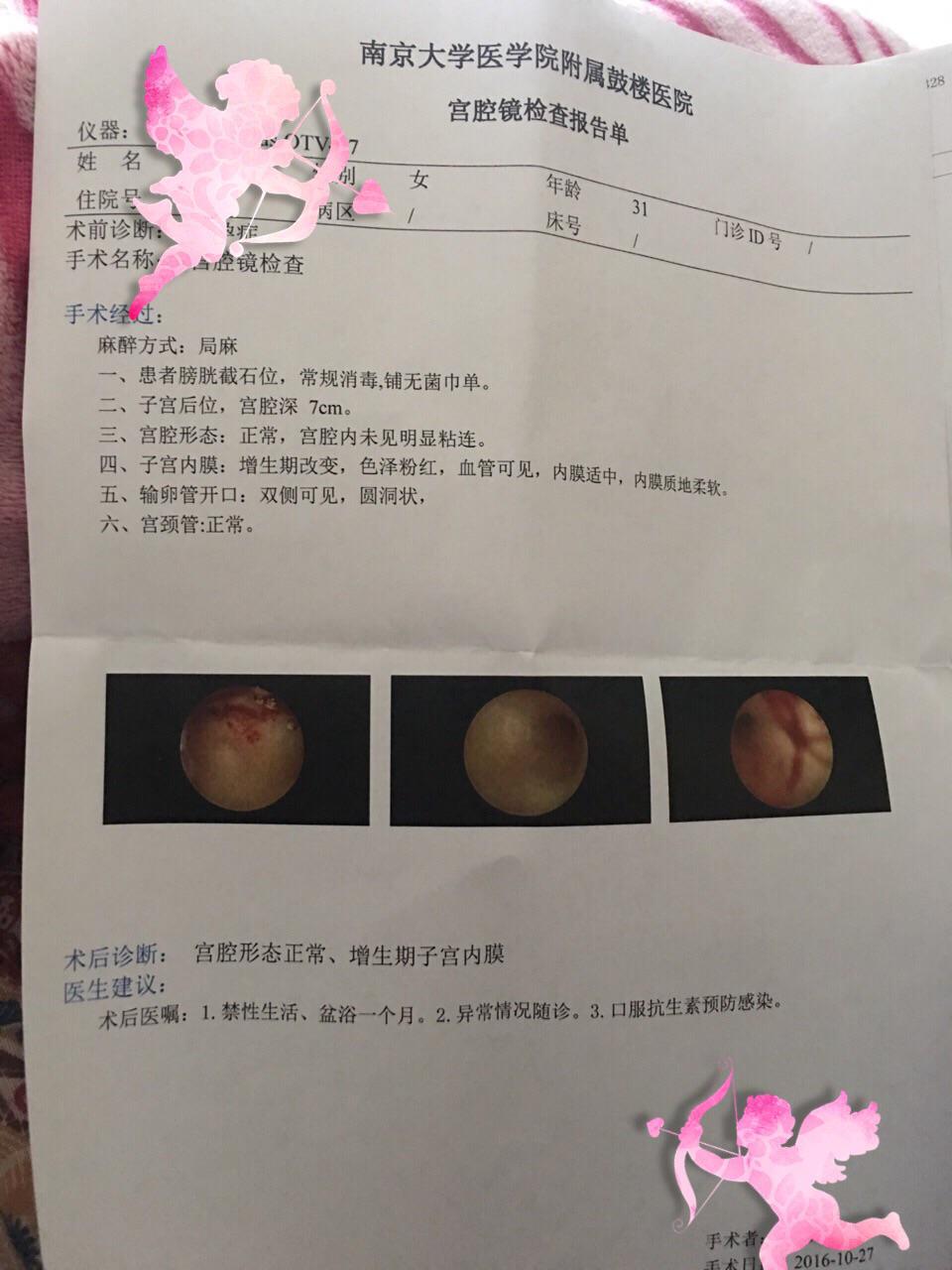 宫腔镜检查