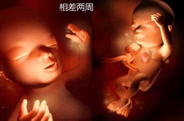 同卵双胞胎还是异卵双胞胎_同卵双胞胎_同卵和异卵双胞胎